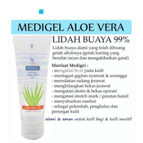 Aloe vera luka bakar