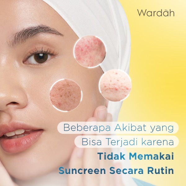 Bunga matahari untuk kulit