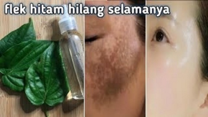 Daun pepaya penghilang flek