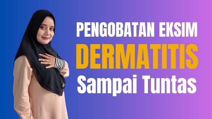 herbal penyembuh eksim
